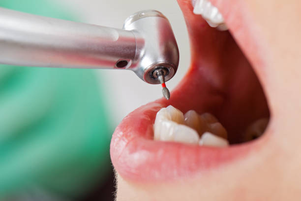 Best Emergency Dental Surgery in St Helen, MI